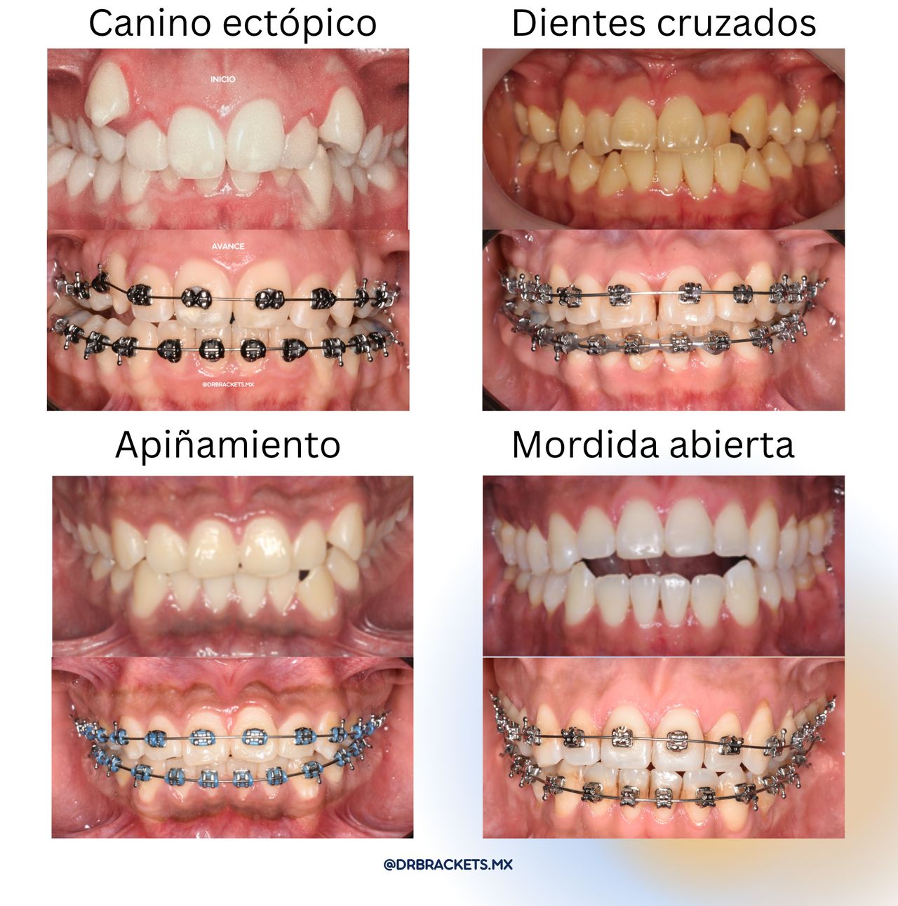 Bryan Patricio Brazales Molina-2