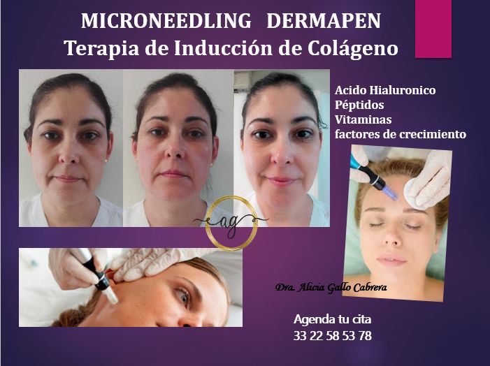 Alicia Gallo Cabrera-13