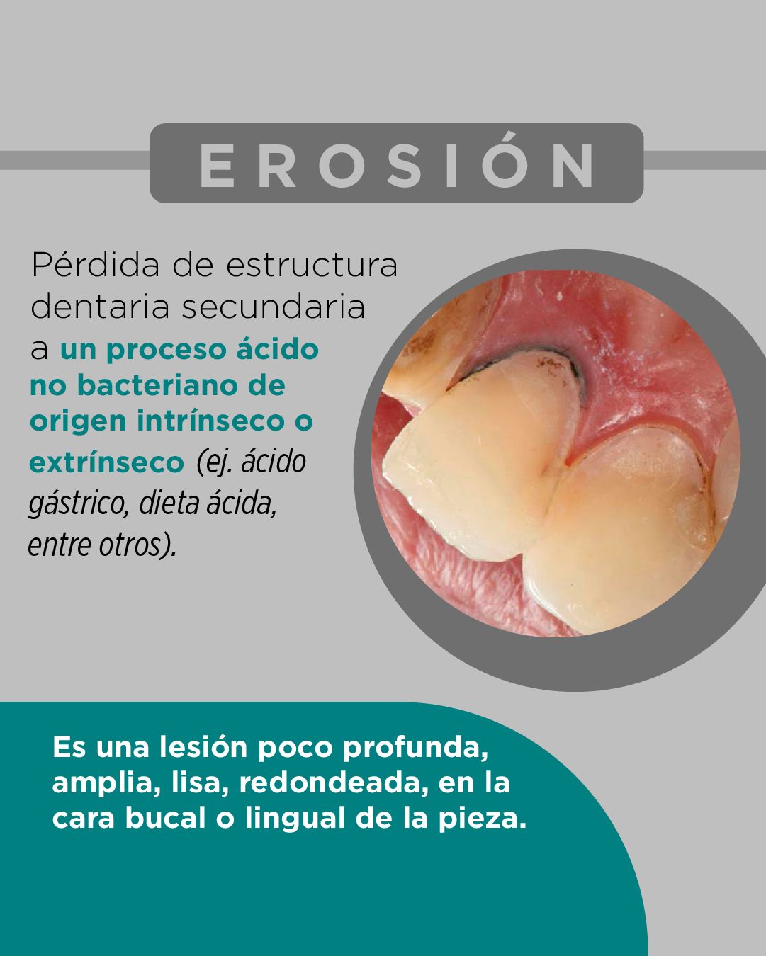 Diana De La Torre Priego-6