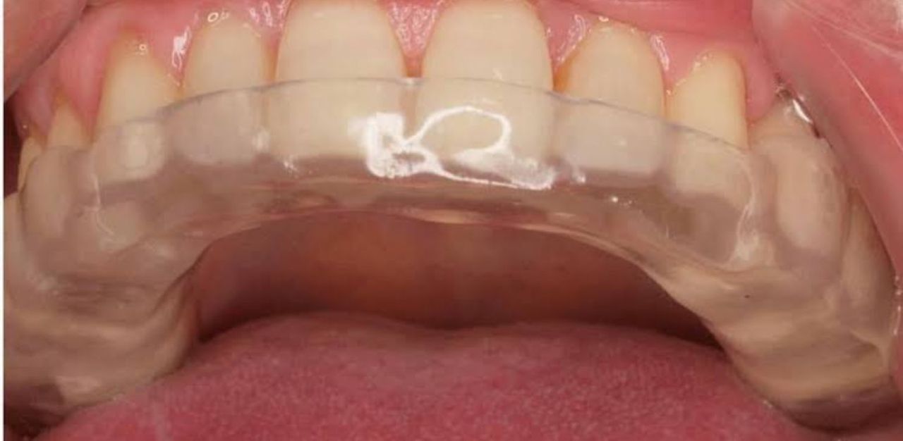 Fredy Alejandro Roblero Gónzalez-36