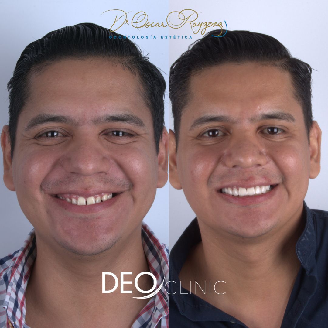 Oscar Raygoza Carrillo-29