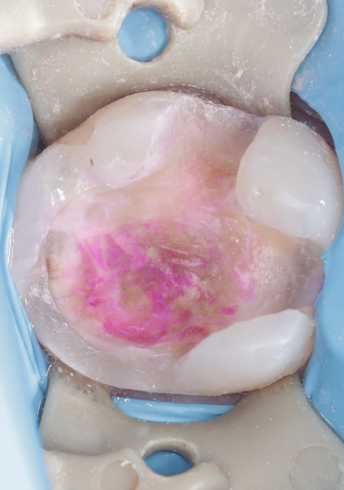 Fredy Alejandro Roblero Gónzalez-52