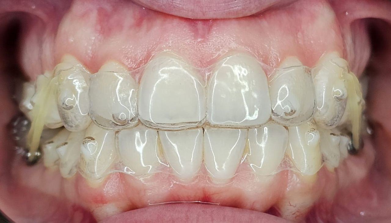 María Rossana Robles Sánchez-21