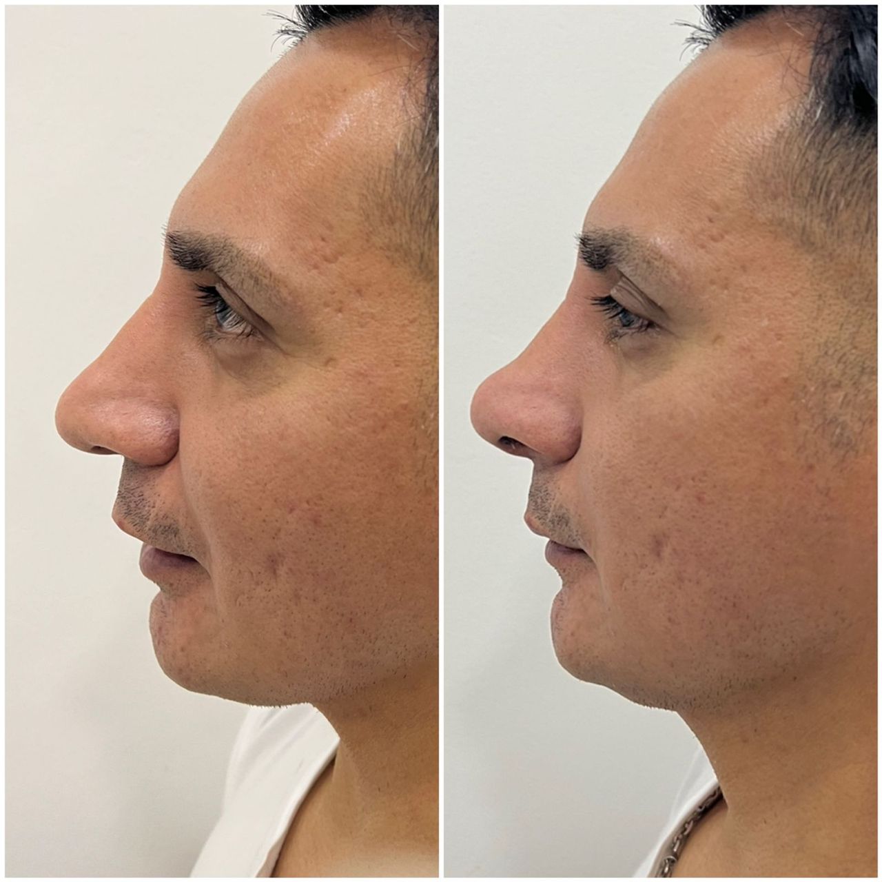 Juan Herrera Hernández-26