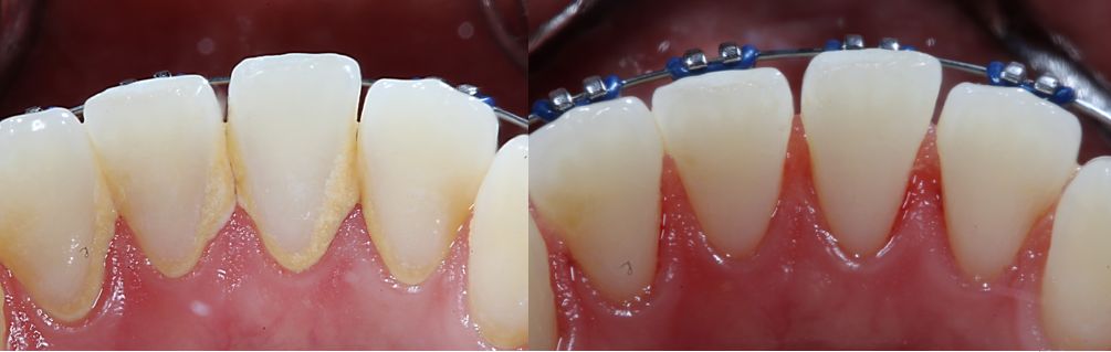 Ireri Rojas Bermúdez-9