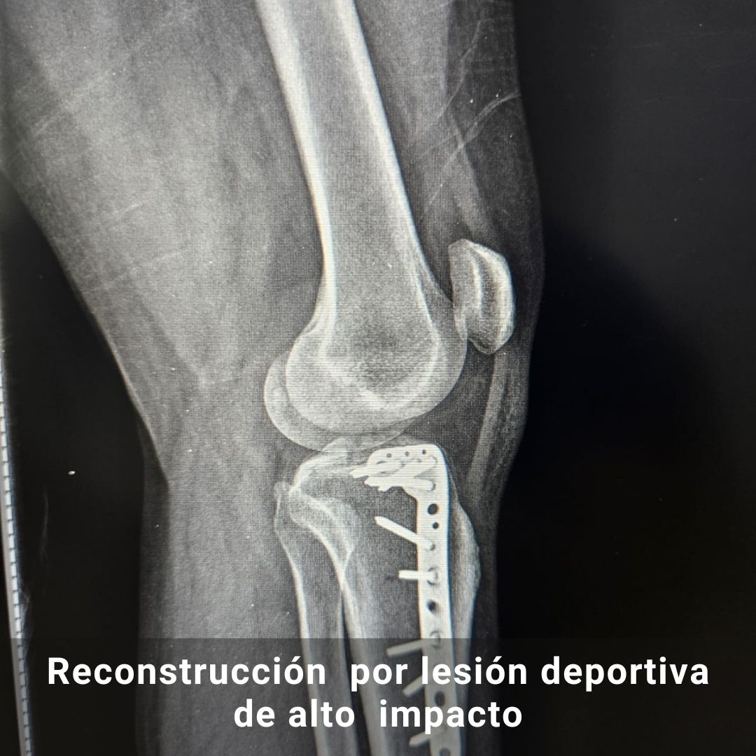 Fernando Zuñiga R.-2