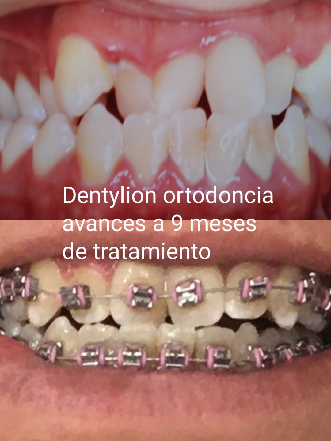 Jessica De La Barrera Valladolid-31