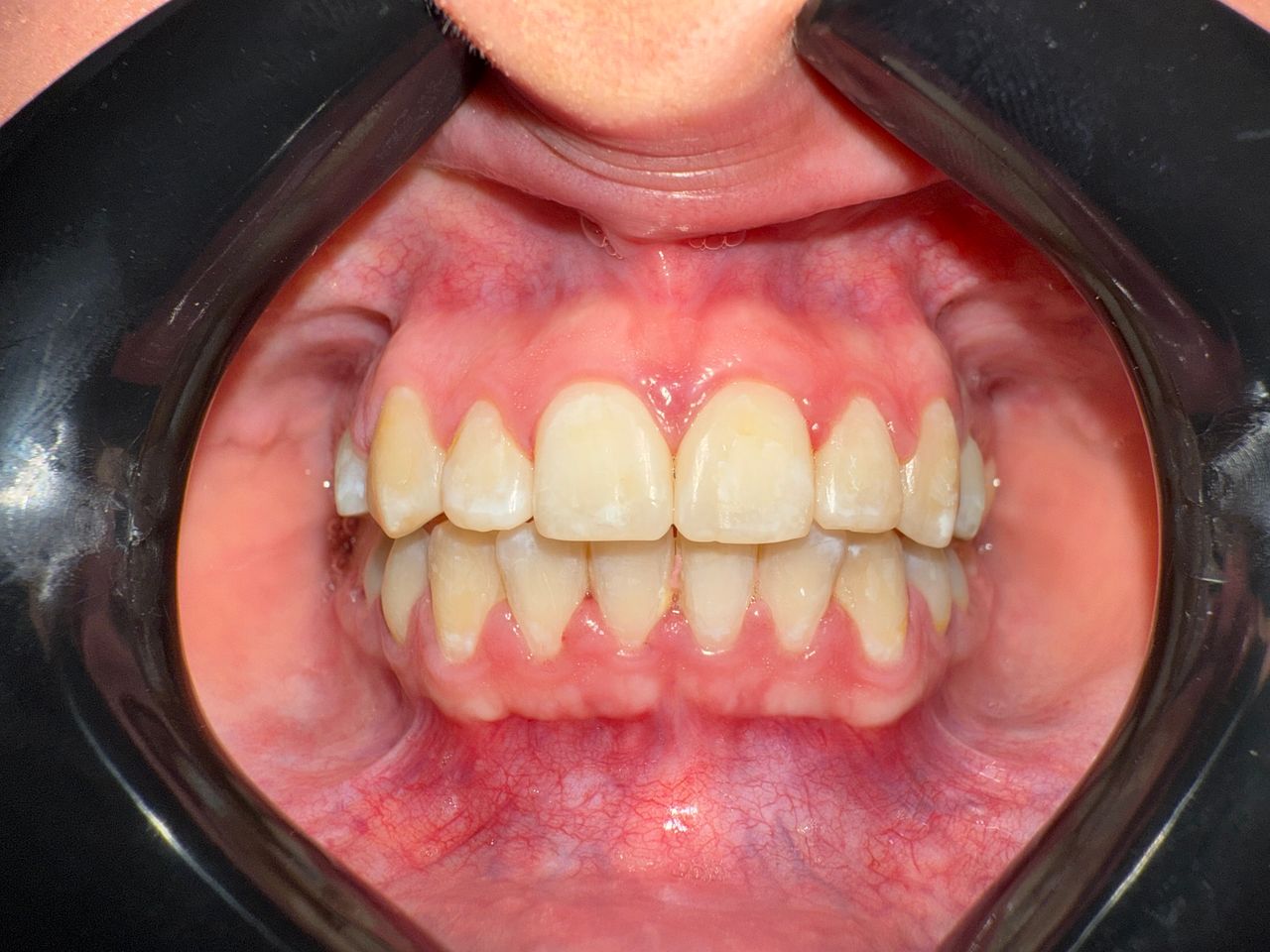 Jair Contreras García-67