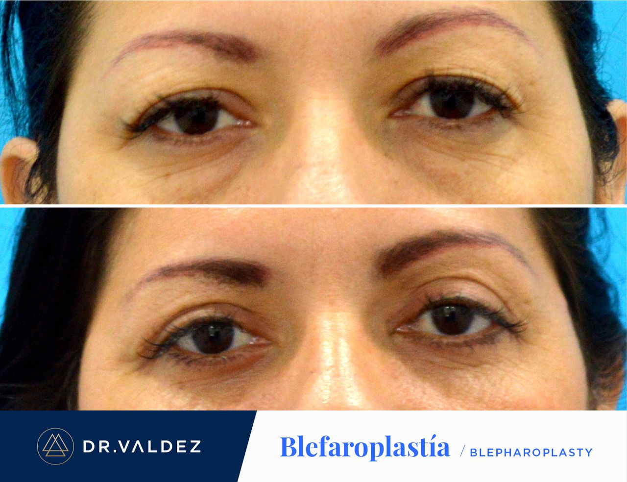 Pedro Arturo Valdez Gomez-30