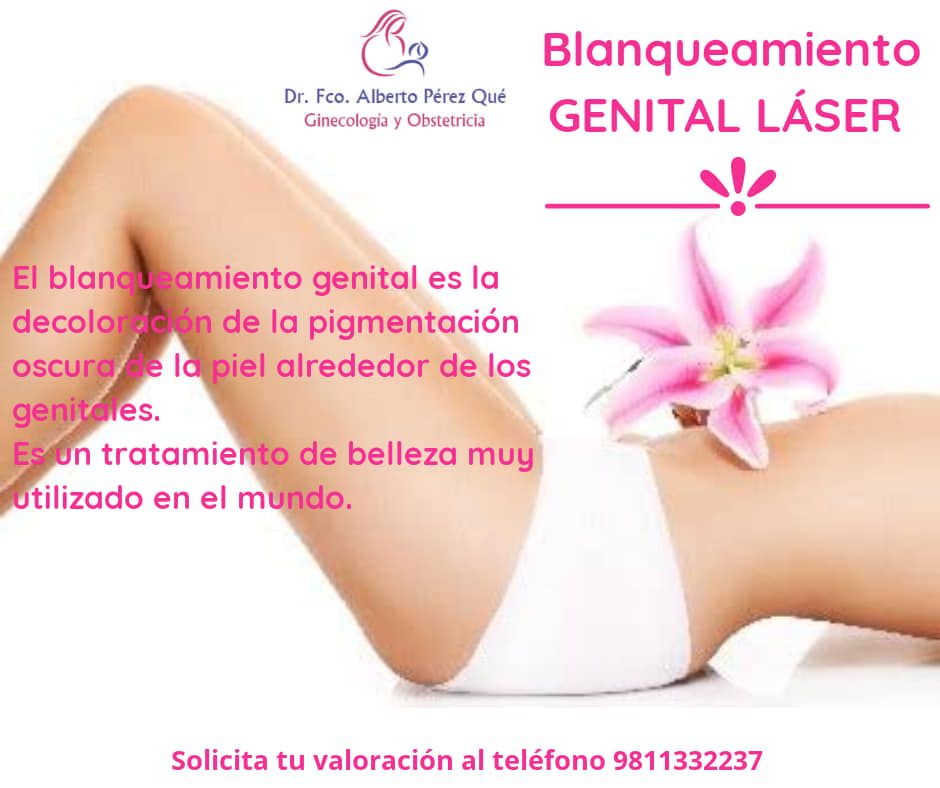 Francisco Alberto Perez Que-23