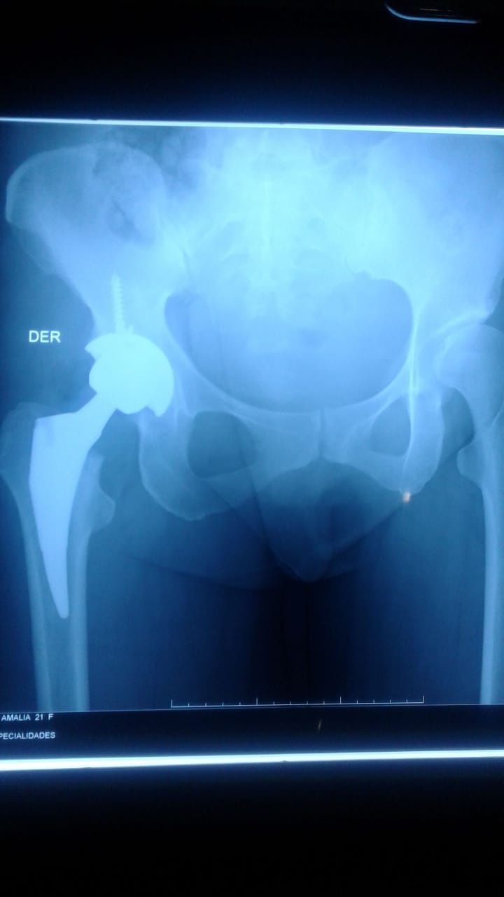 Moises Moreno Martinez-2