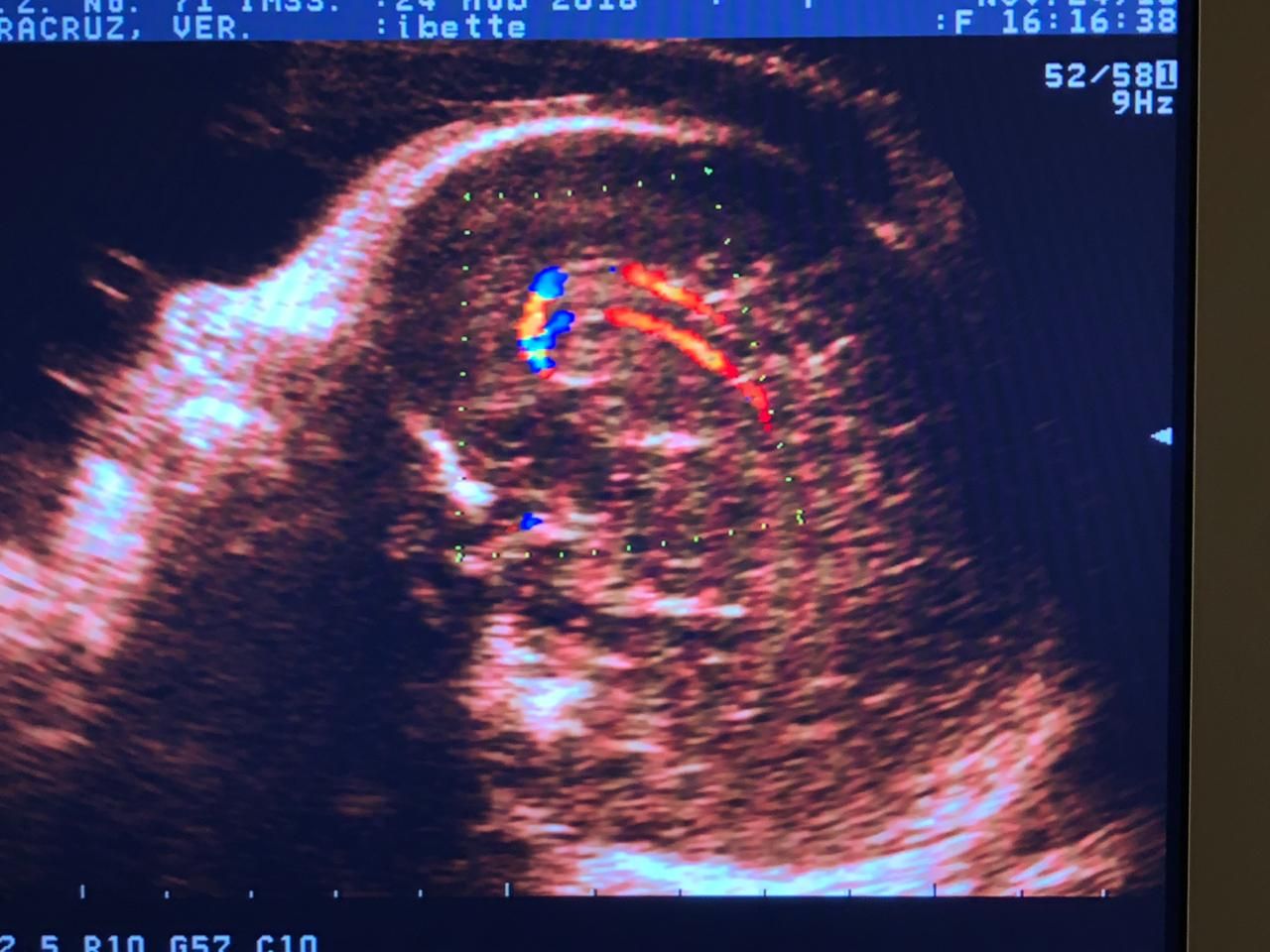 Nalliely Hernández Sebastian-3