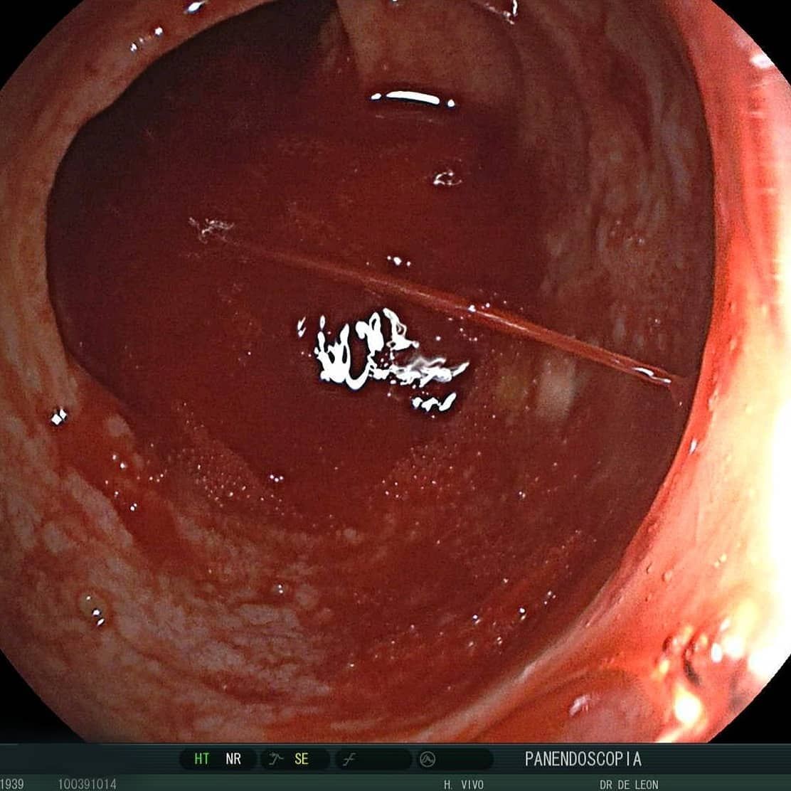 Edgar Alan De León Rojas-7