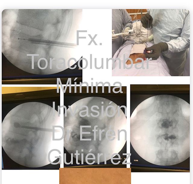 A. Efrén Gutiérrez Bautista-2