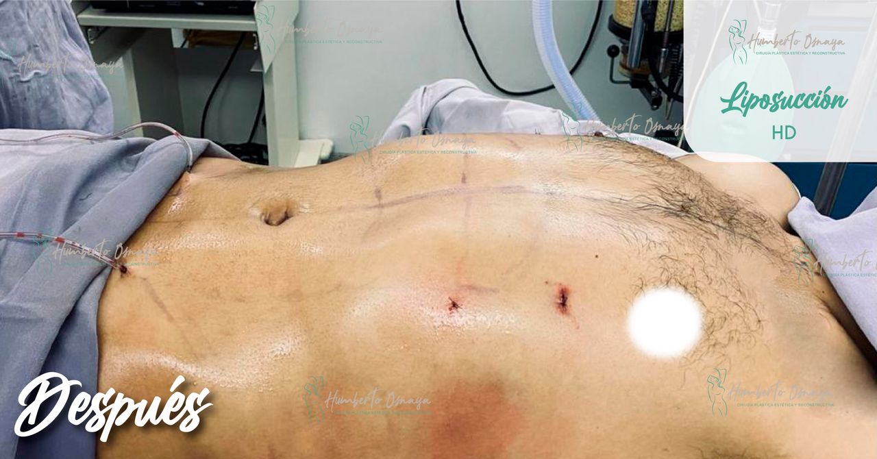 Humberto Osnaya Moreno-14