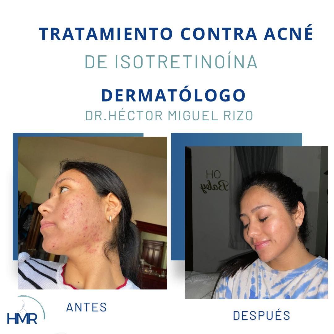 Hector Miguel Rizo Aceves-7