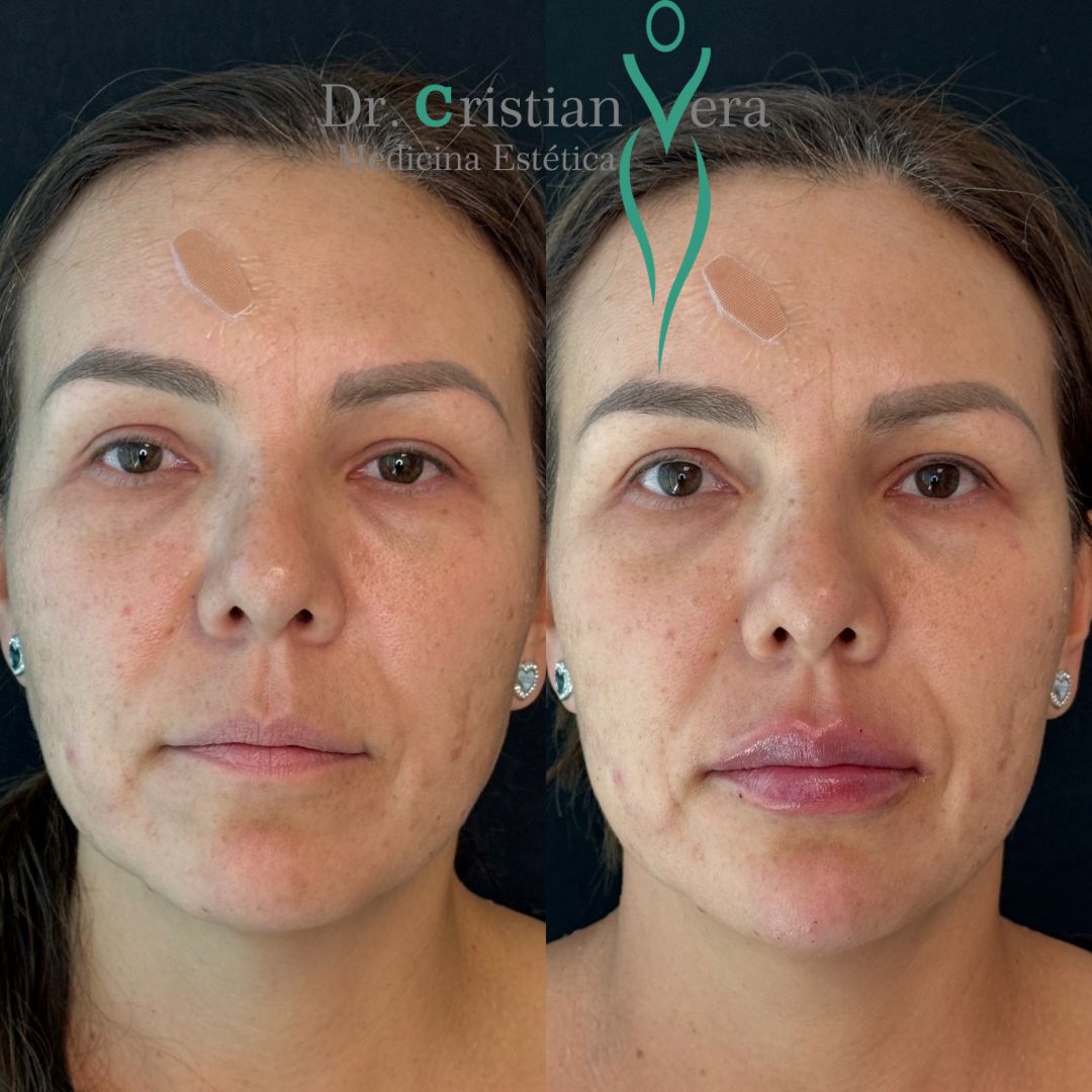 Cristian Eduardo Vera Nuño-19