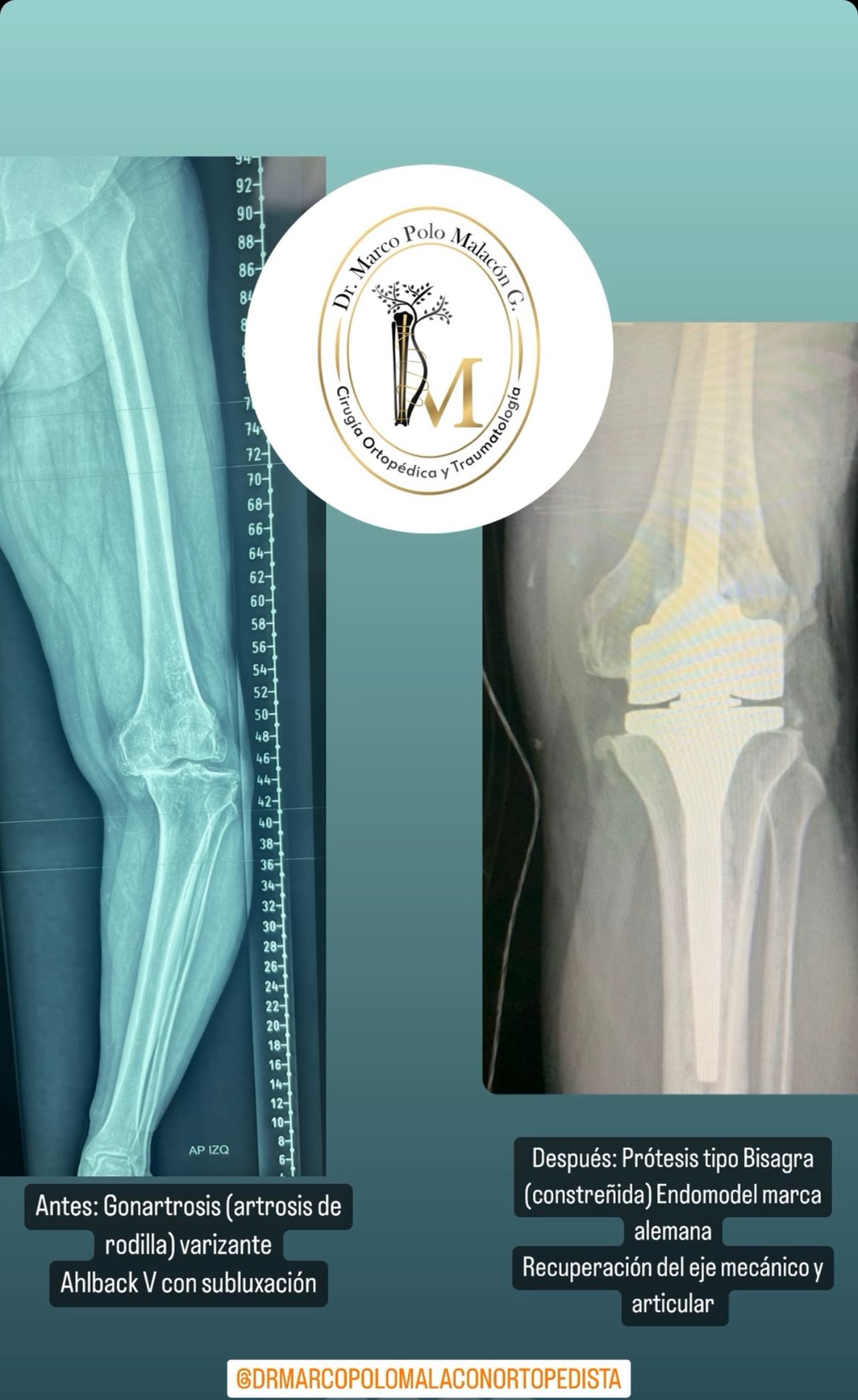 Marco Polo Malacón Gutiérrez-12