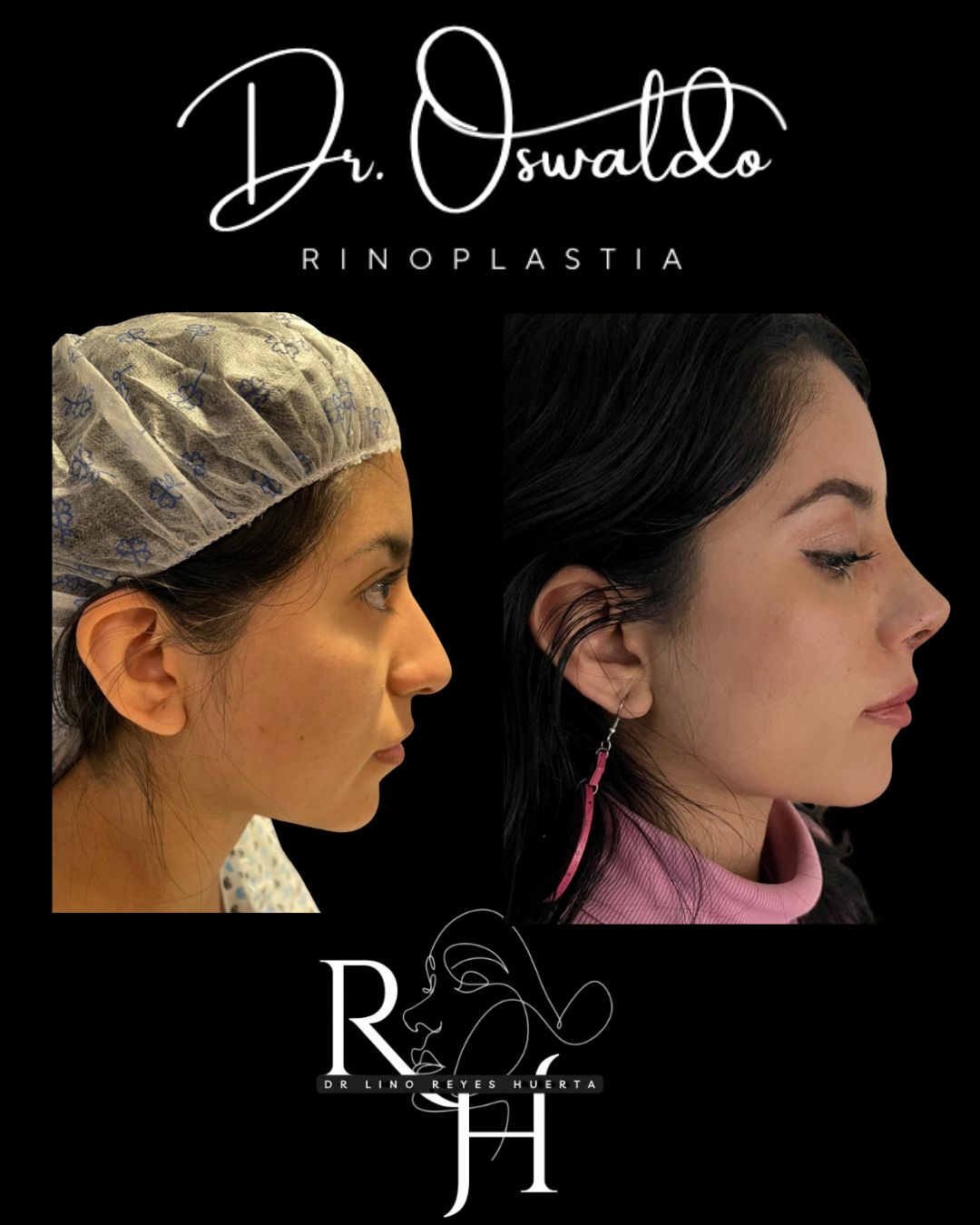 Lino Oswaldo Reyes Huerta-2