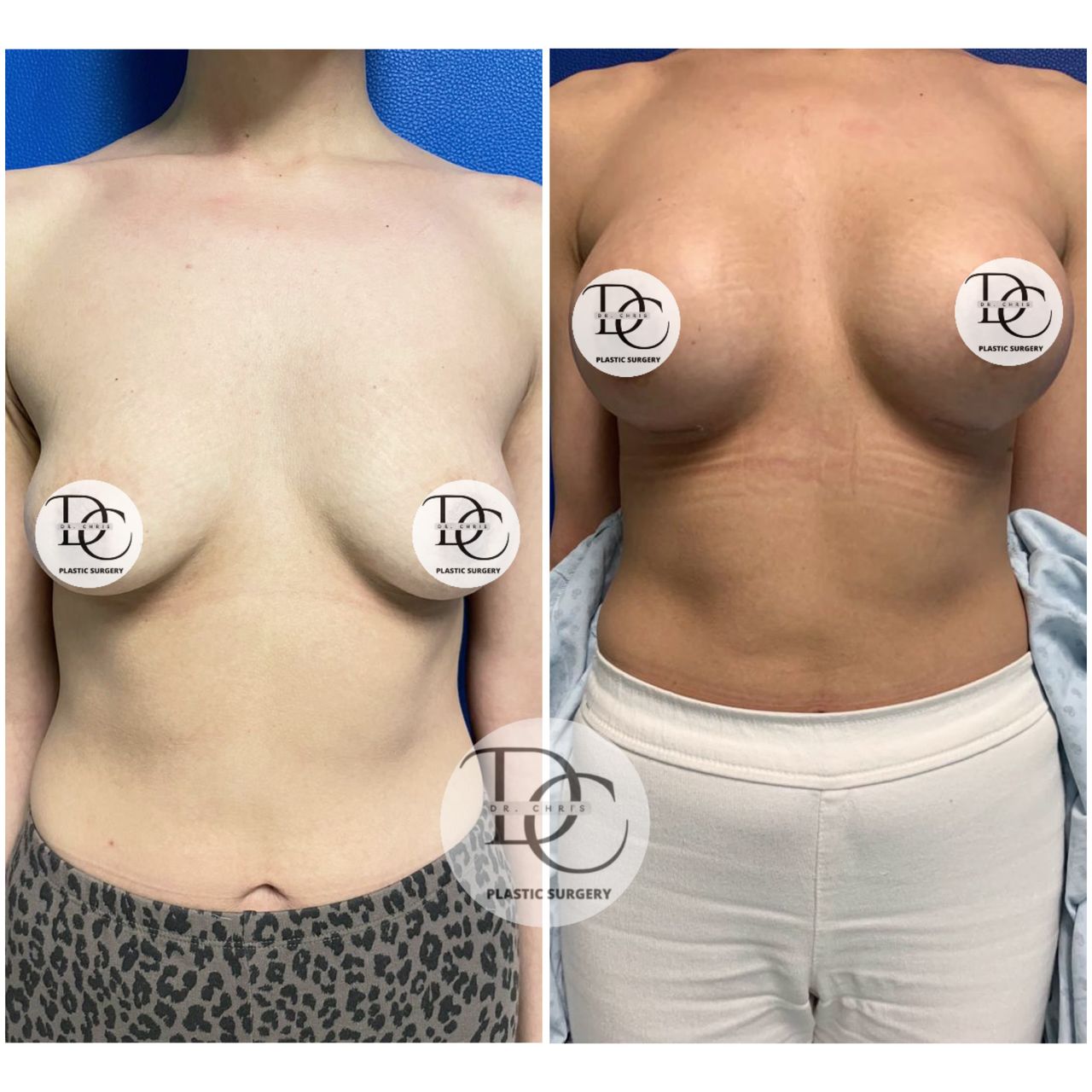 Christian Porras Mendez-14