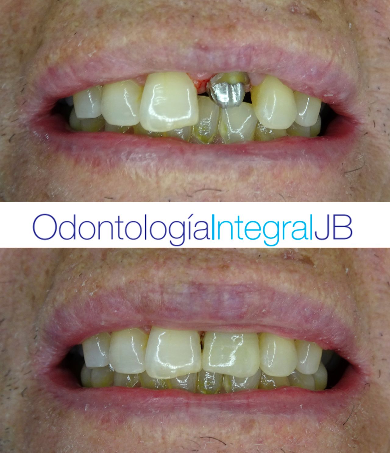 Jacqueline Bazán Díaz-14