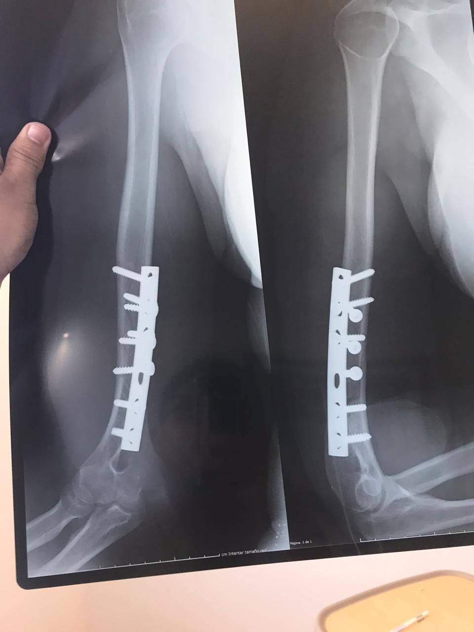 Alberto Viñas Silva-9