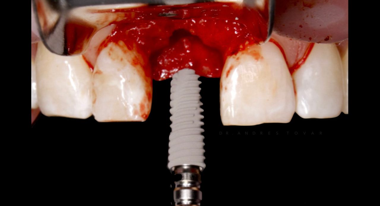 Andrés Tovar López-23