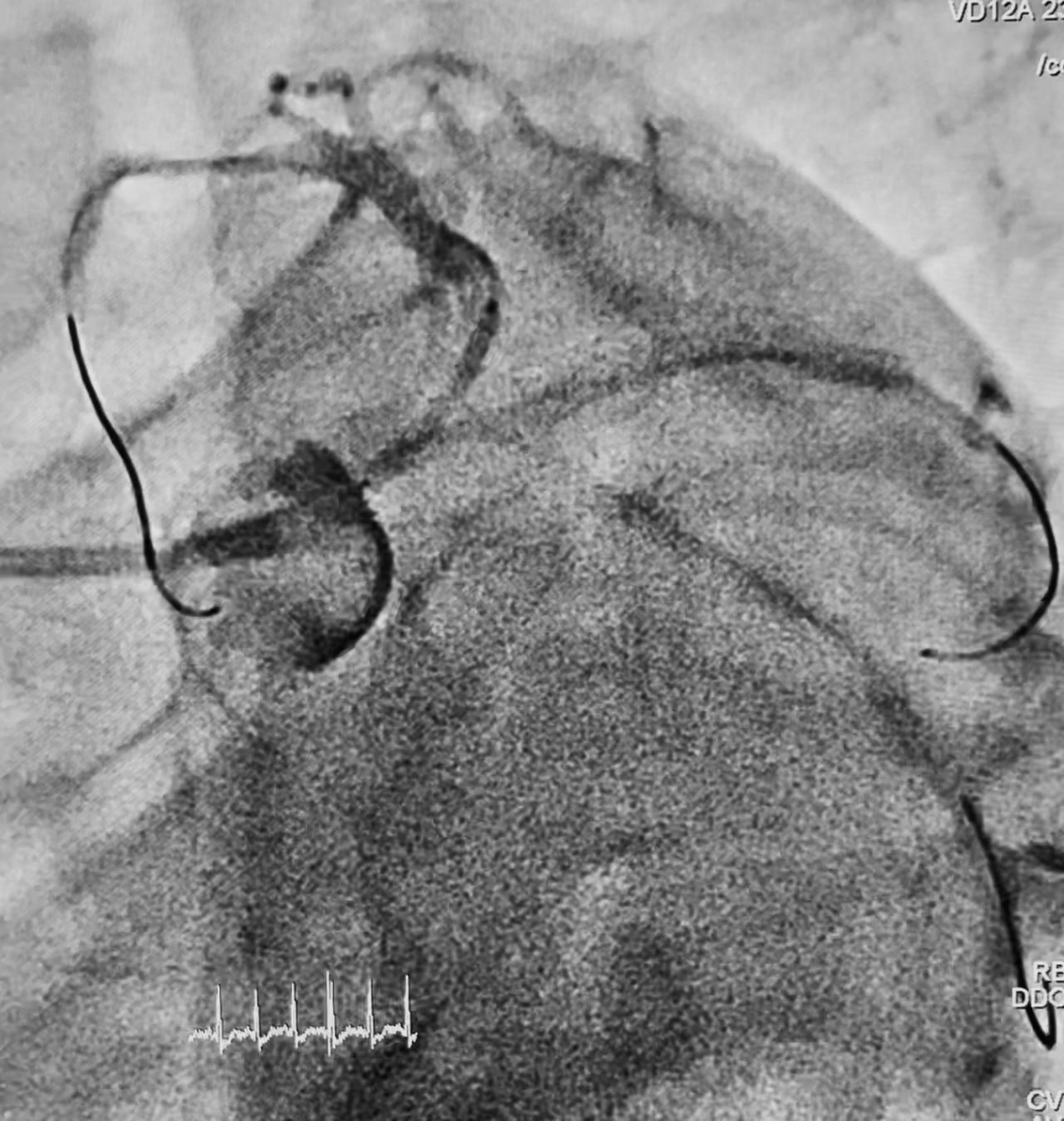 Abdón Ávila Chávez-5