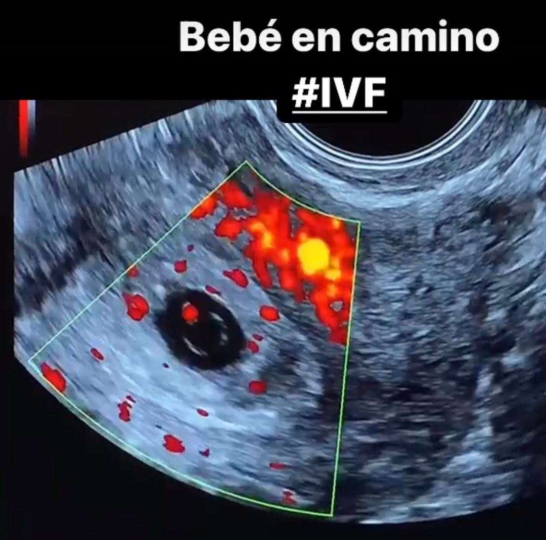 Ana Celia Mendoza Ocampo-1