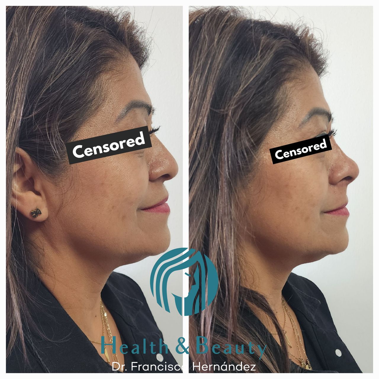 Francisco Hernández Gómez Crespo-29