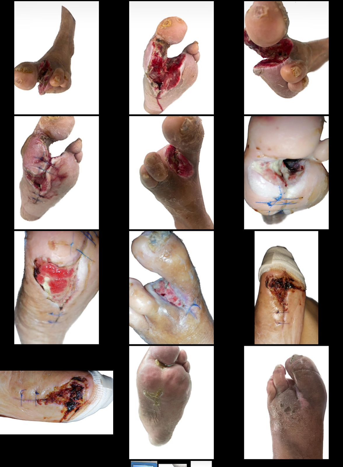 David Reyes Jimenez-11