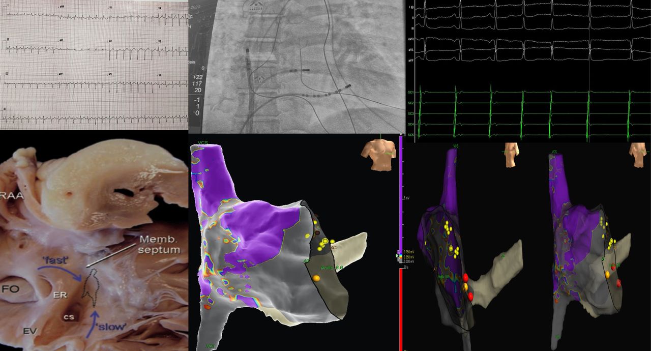 Karim Yarek Juarez Escobar-4