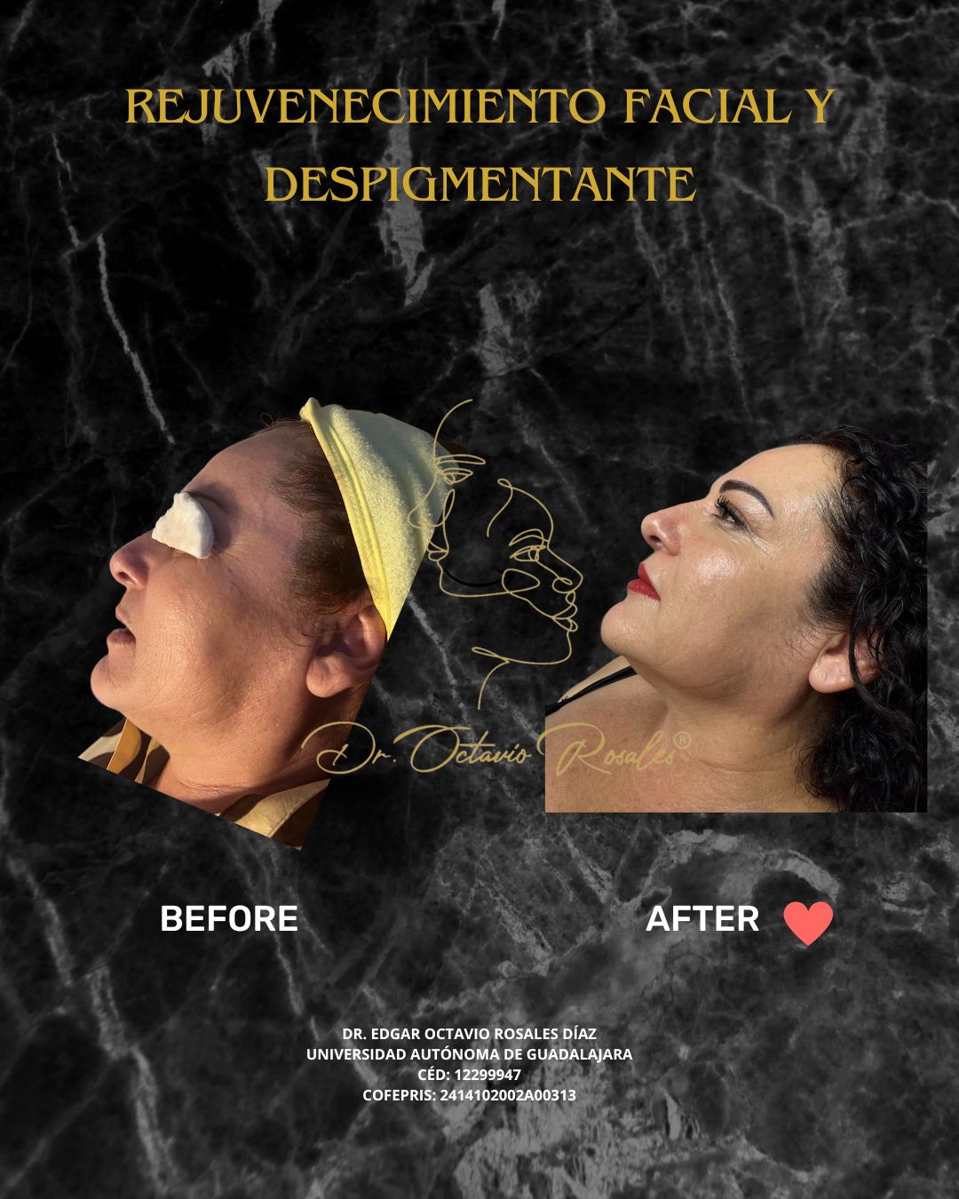 Edgar Octavio Rosales Diaz-22