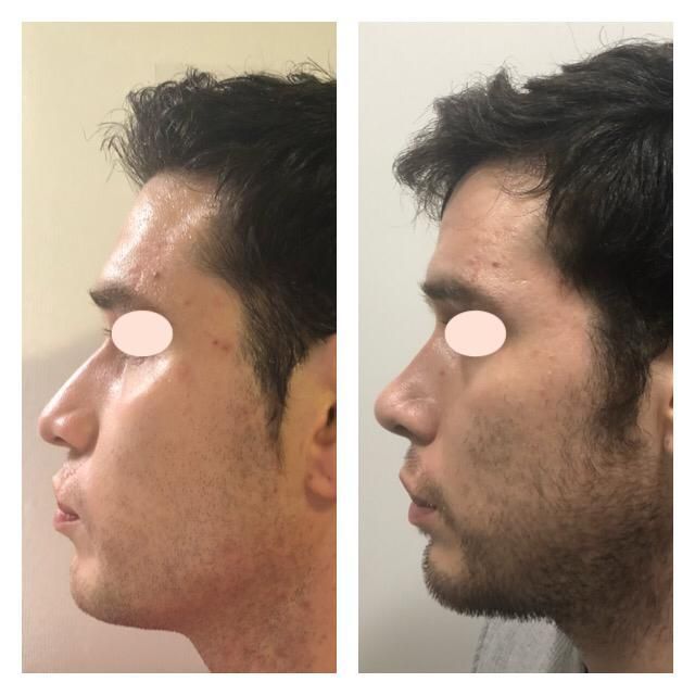 Carola Berenice Curiel Davalos-33