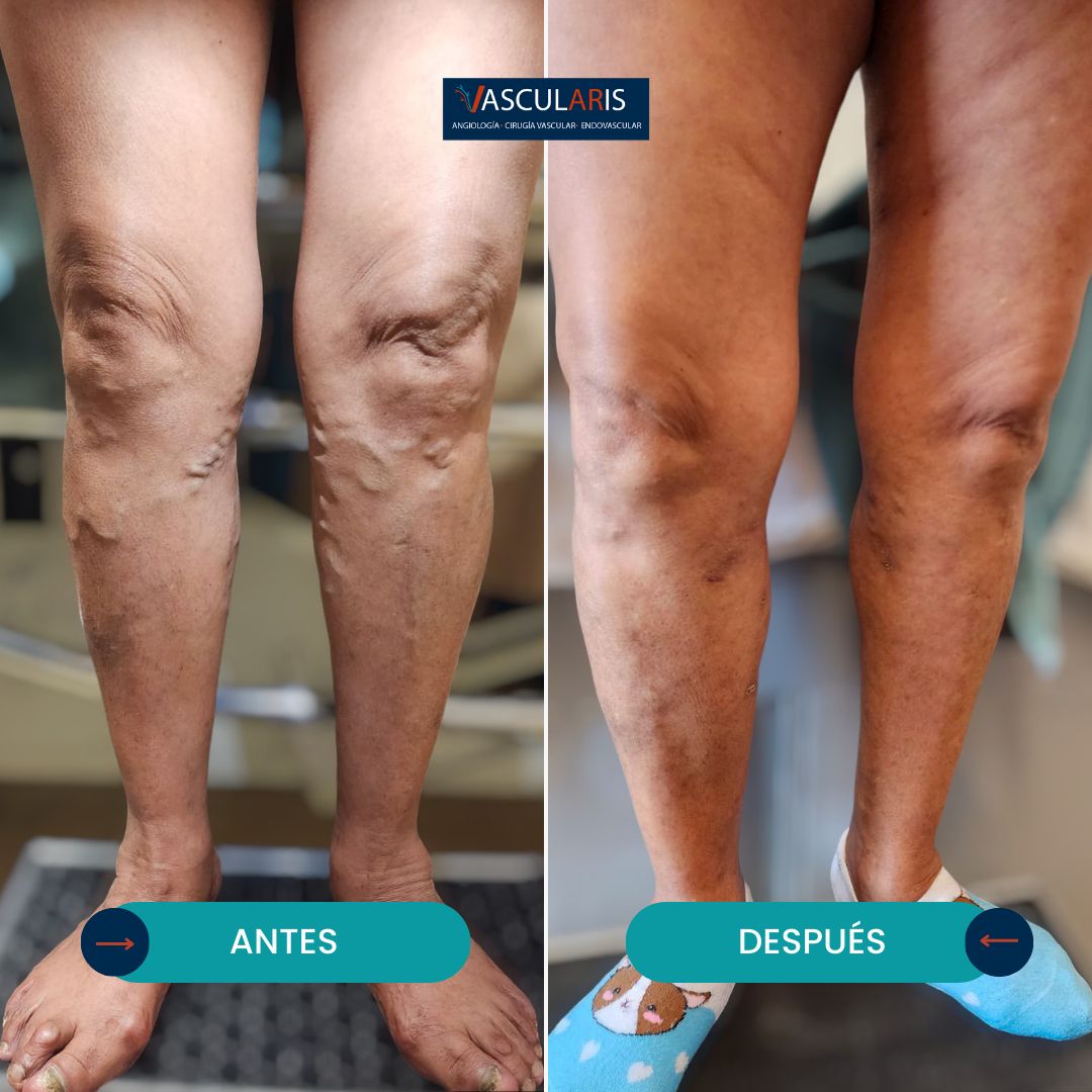 Jose Aristeo Reyes Monroy-2