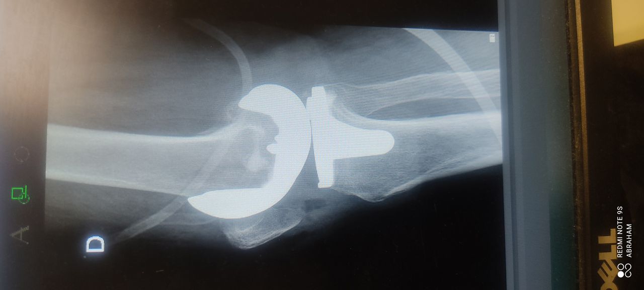 Abraham Israel Tachiquín Ruiz-3