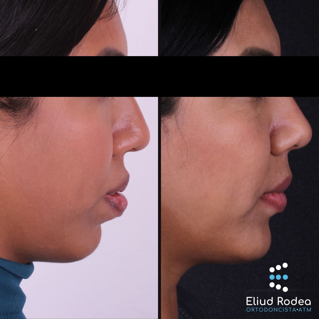 Eliud Rodea Monsivais-3