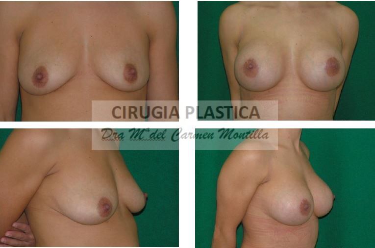 María Del Carmen Montilla Muñoz-1