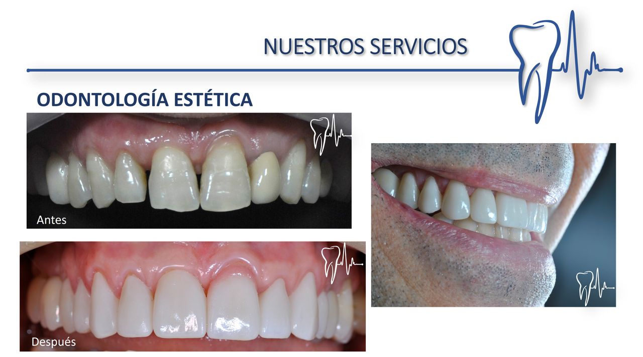 Alberto Companioni Bacha-17