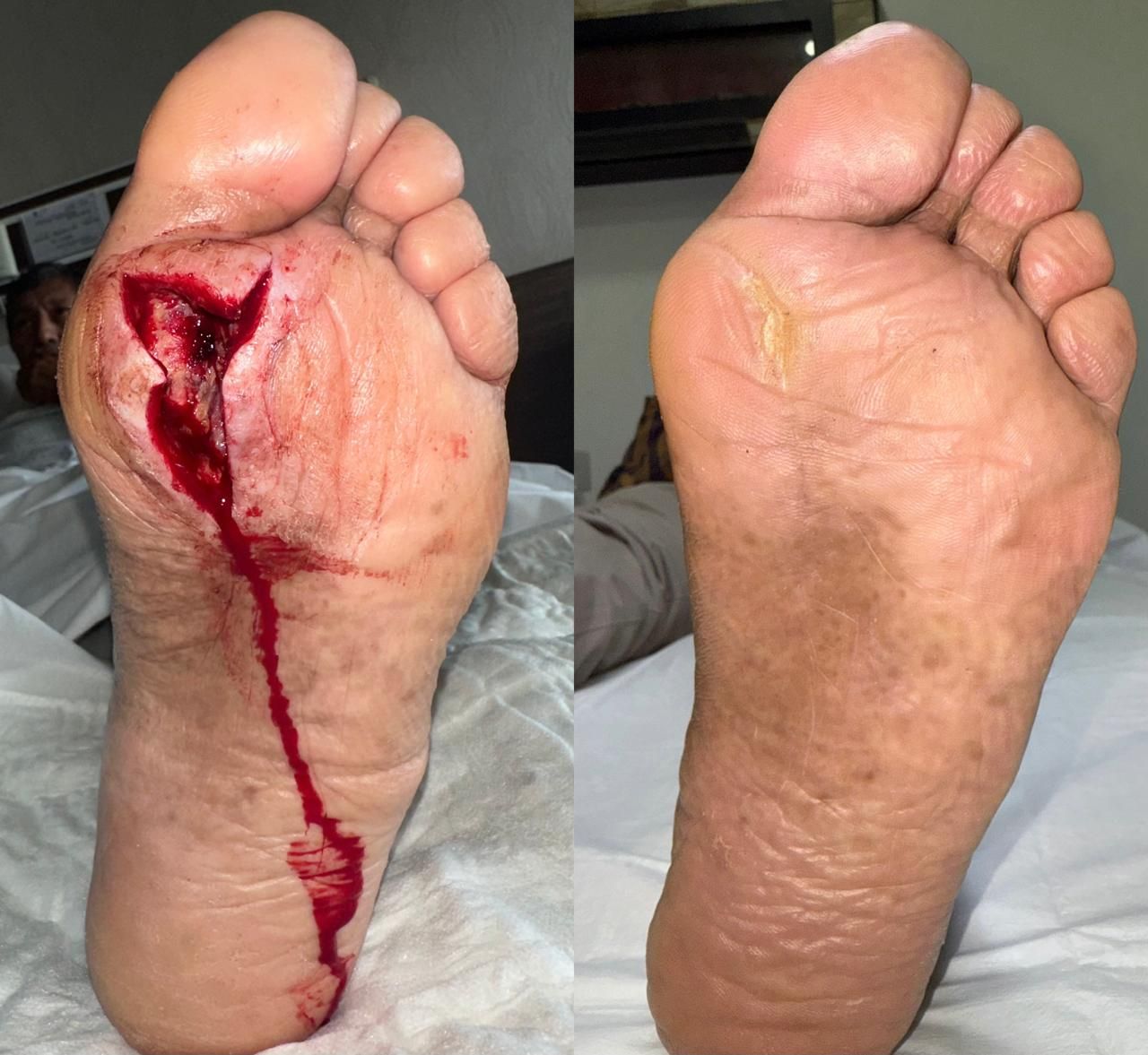 Jhonatan López González-18