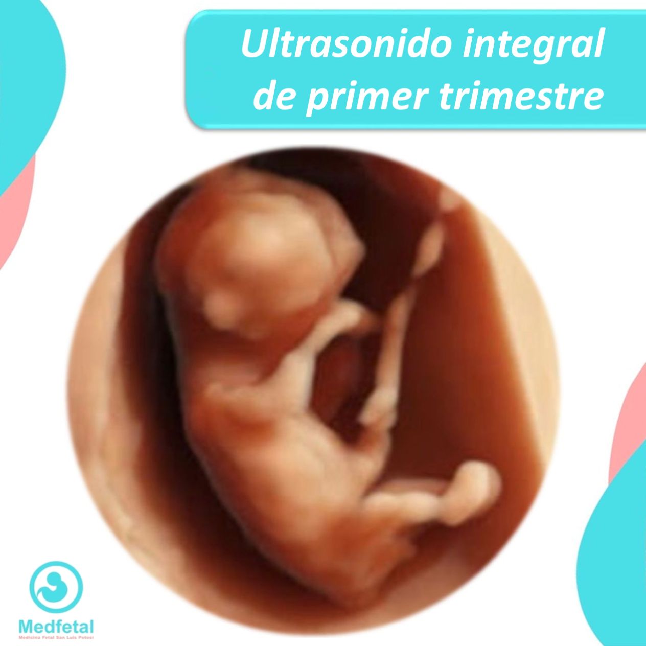 Manuel Ulises Reyes Hernández-7