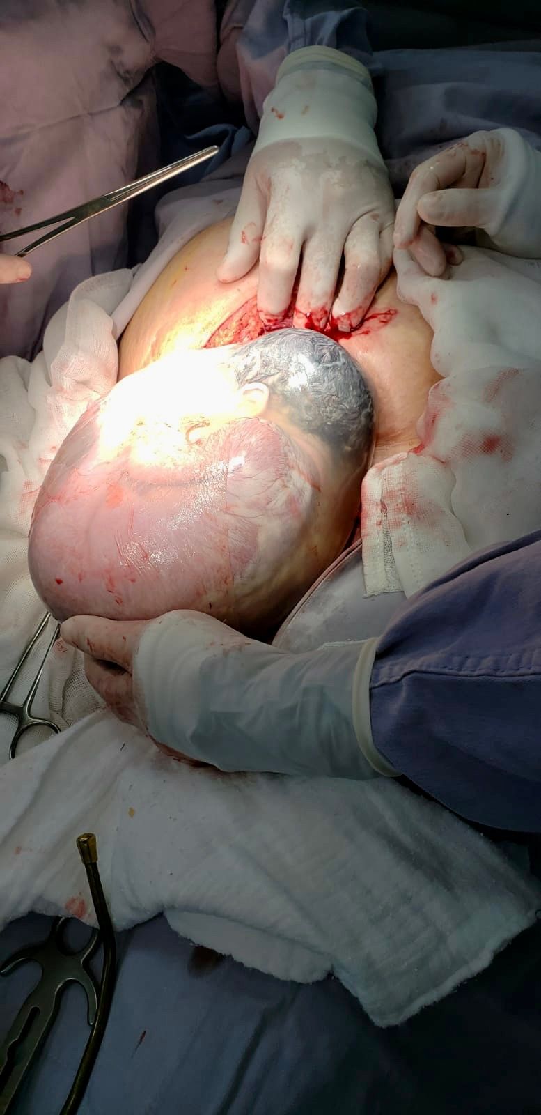 Josue  Neftaly Orizaba Moreno-3