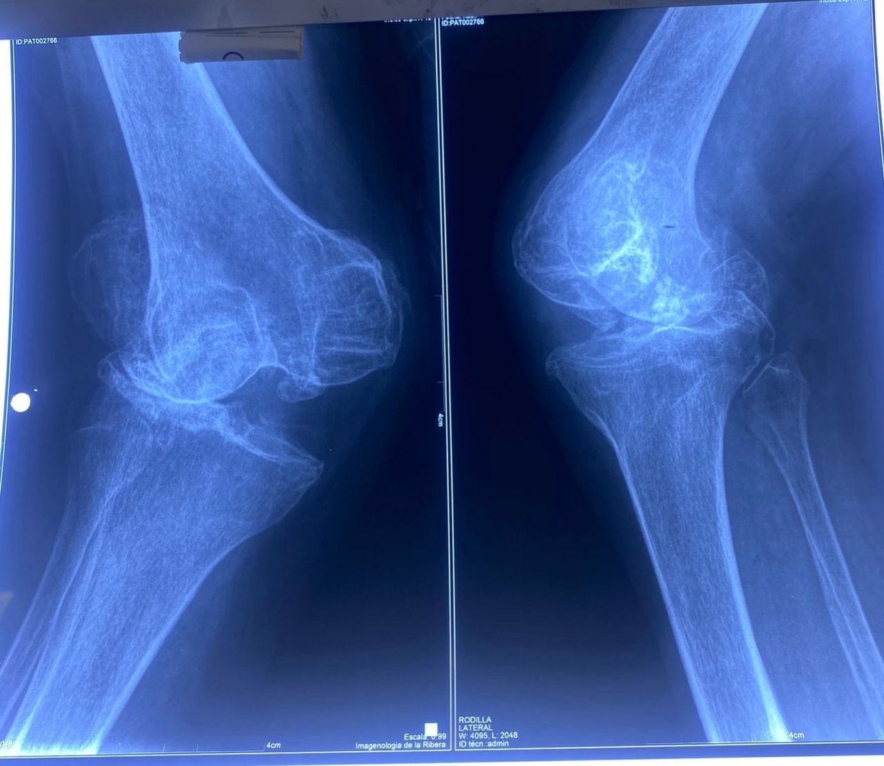 Cristian Ernesto Murillo Medina-11