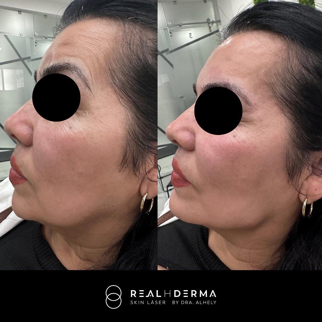 Laura Alheli Niebla Maldonado-10