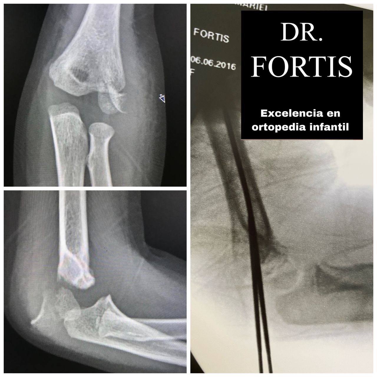 Ignacio Osvaldo Fortis Olmedo-8