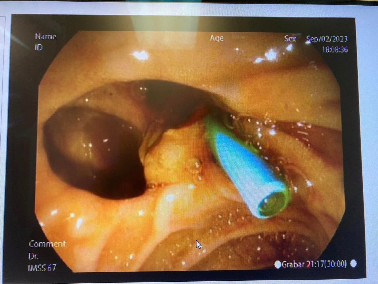 J. César Reyes Vásquez-25