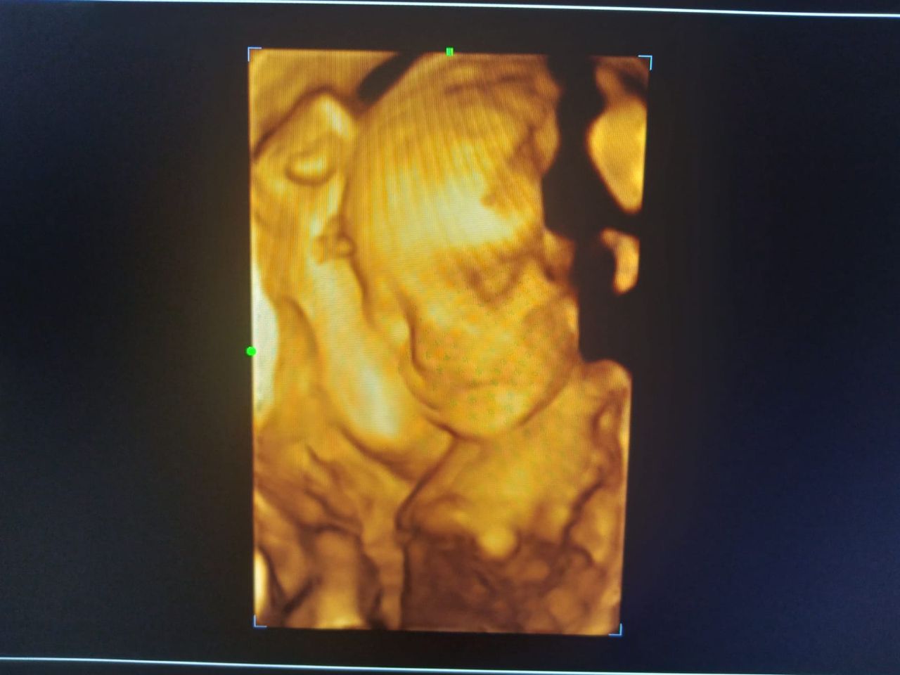 Fredy Pineda Bustos-2