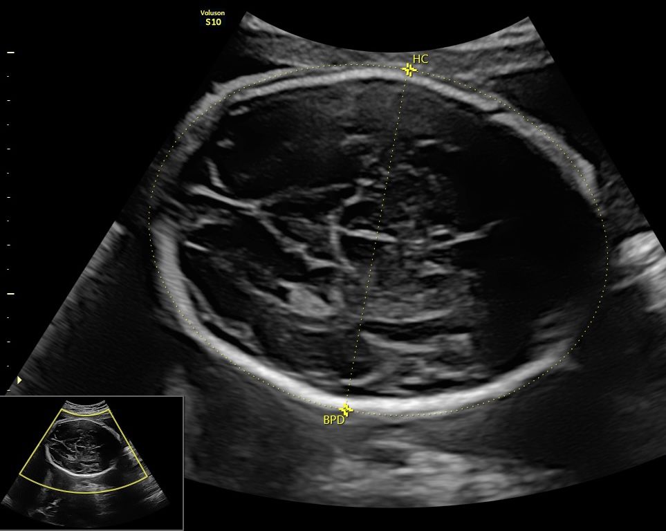 Juan Jose Pacheco Uc-9