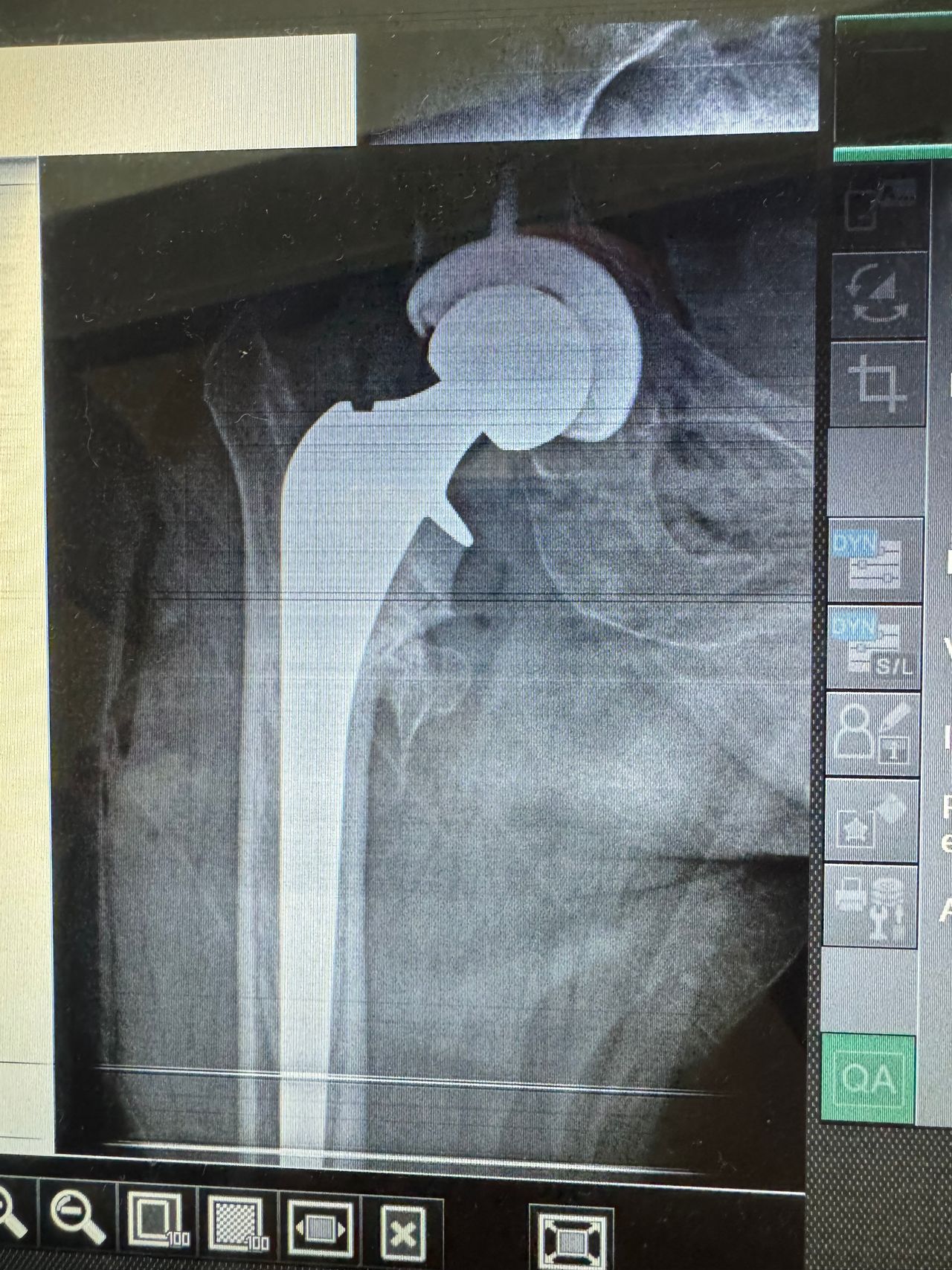 Carmen Yossaleth Briceño González-7