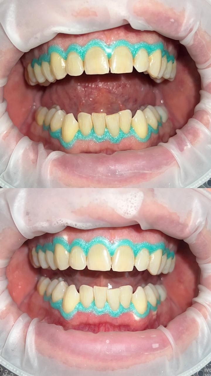 Saydee Guadalupe Pérez Sánchez-1